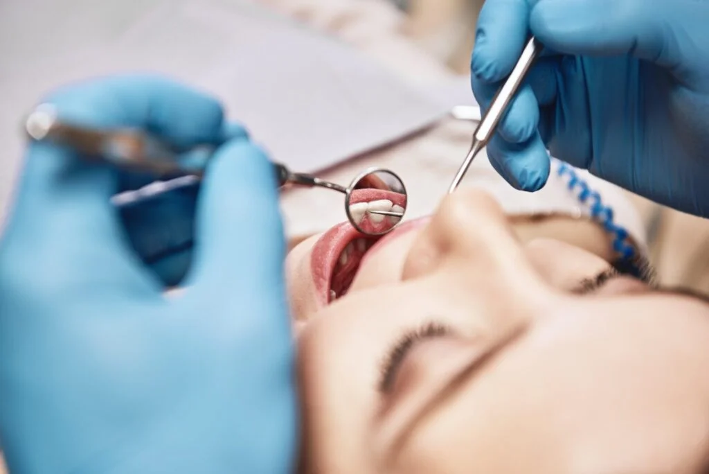 Tratamiento de Caries con Resinas: La solución estética en Clínica Dental Ulloa en Naucalpan de Juárez