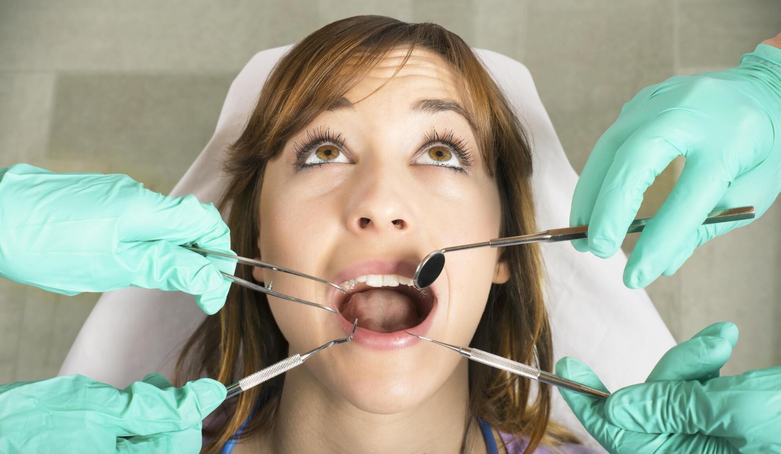 Limpieza Dental en Clínica Dental Ulloa