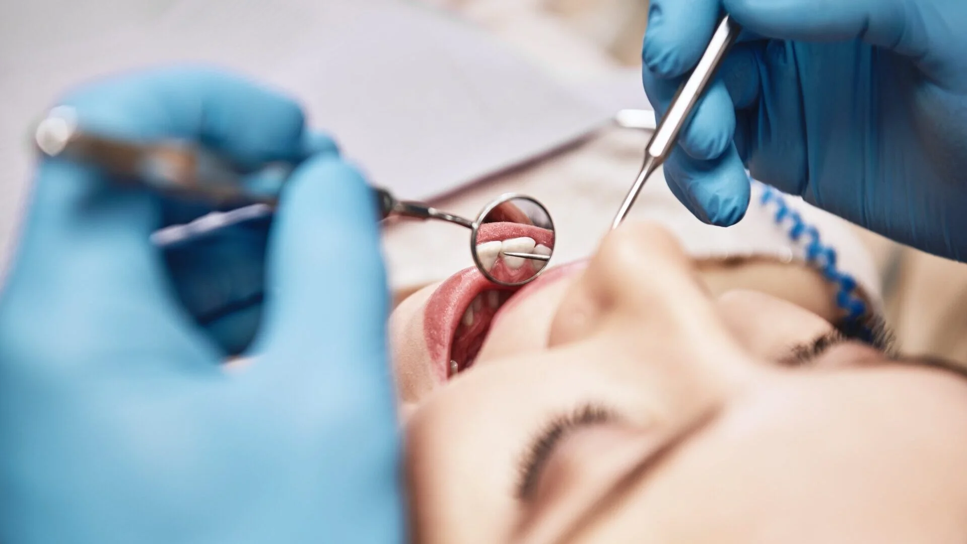 Higiene bucal y prevención periodontal