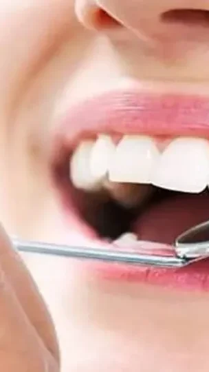 Prevención: claves para proteger tu sonrisa