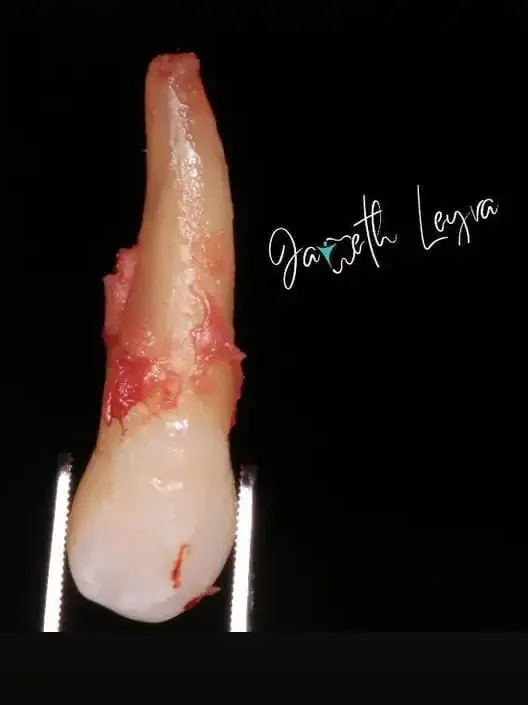 Endodoncista se le llama al especialista en endodoncia.